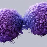 Imagen de células de cáncer de páncreas