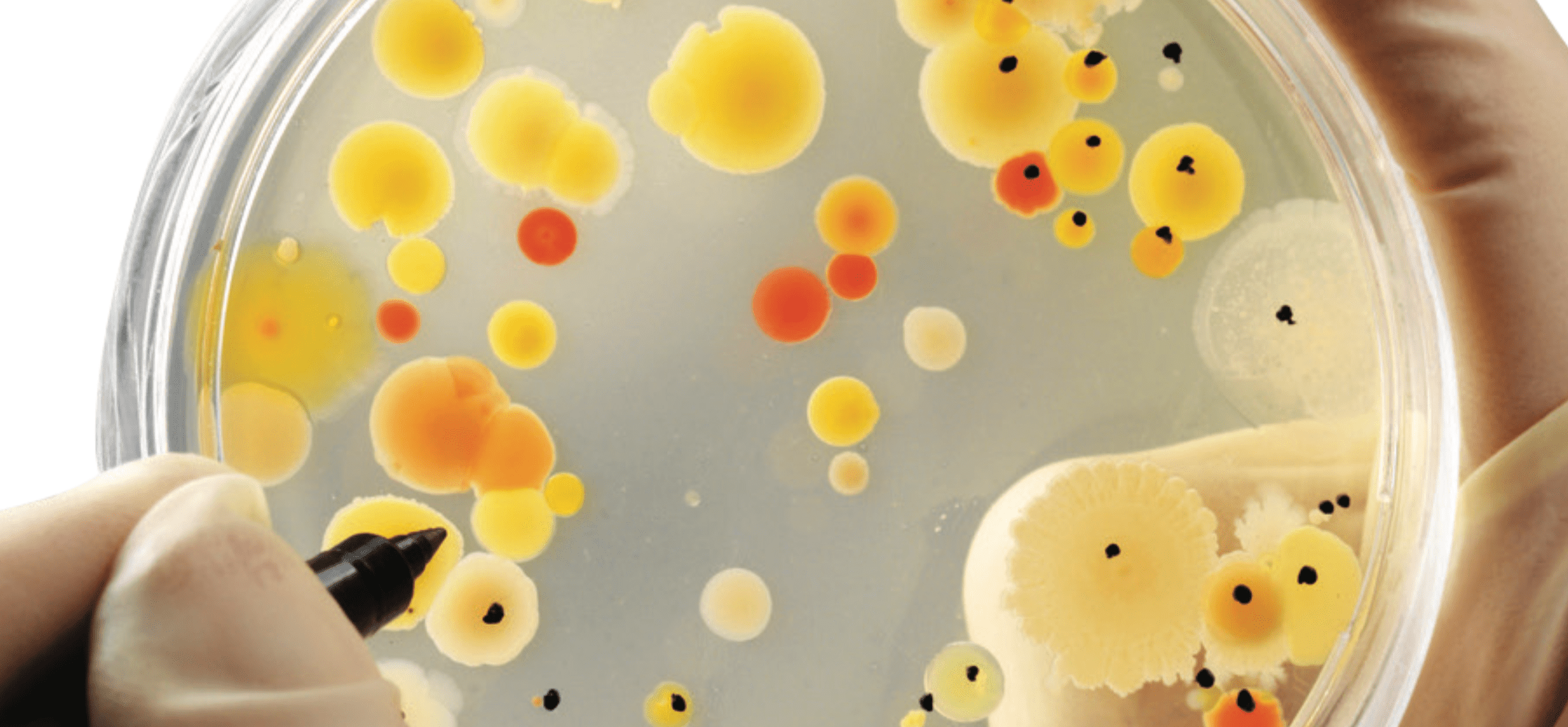 Placa de Petri de células de diferentes colores.