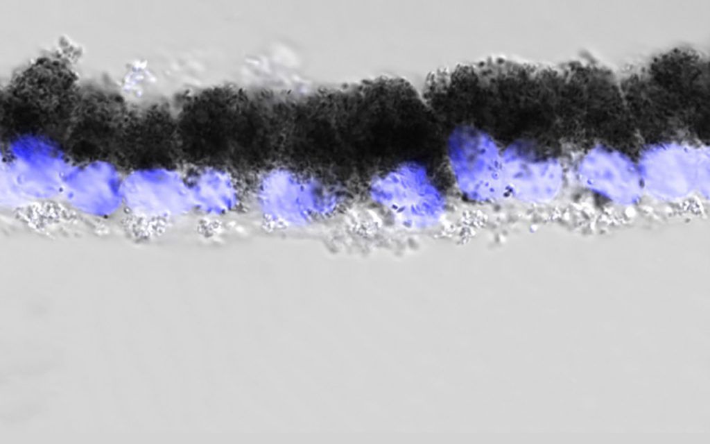 Retinal pigment epithelium layer grown in a dish with DNA labeled in blue