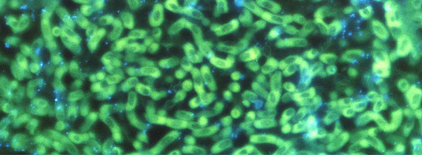 Aspergillus fluorescently stained using anti-bodies