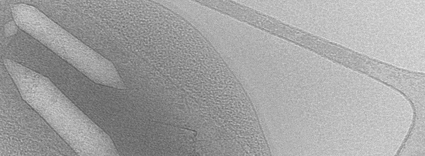 Imagen de microscopía electrónica de células bacterianas