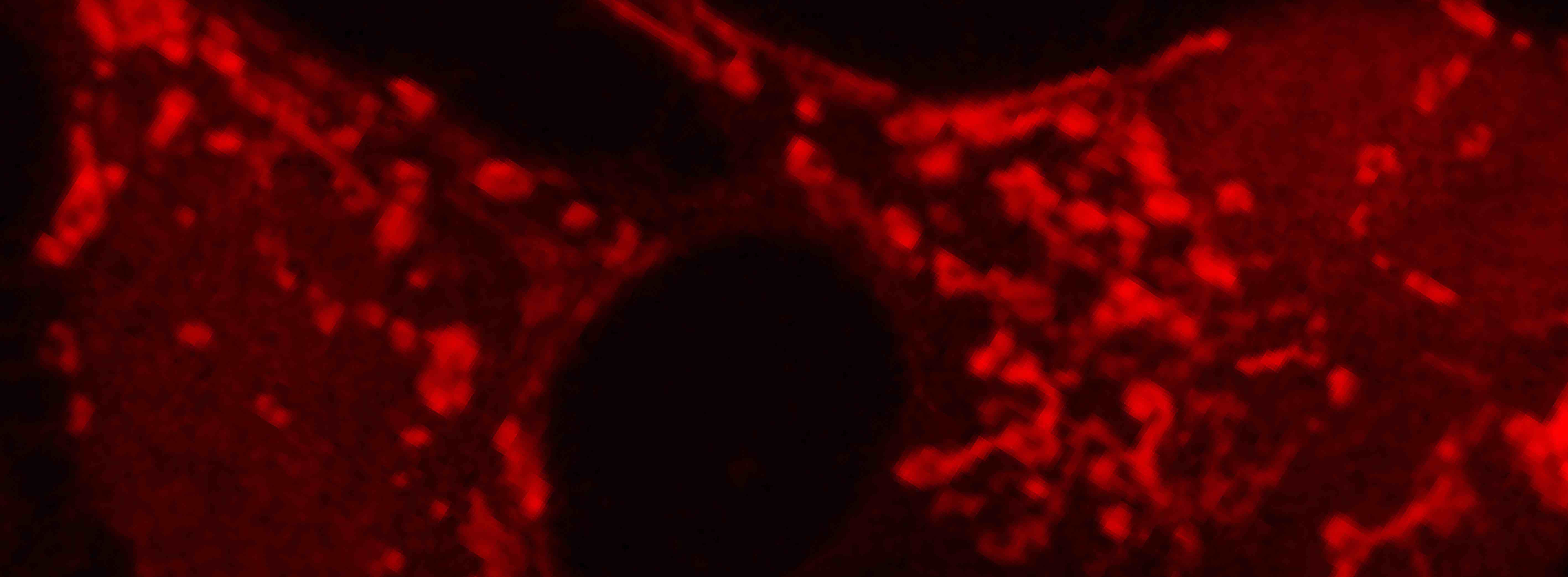 Squirrel brain cells with glowing red fluorescent mitochondria