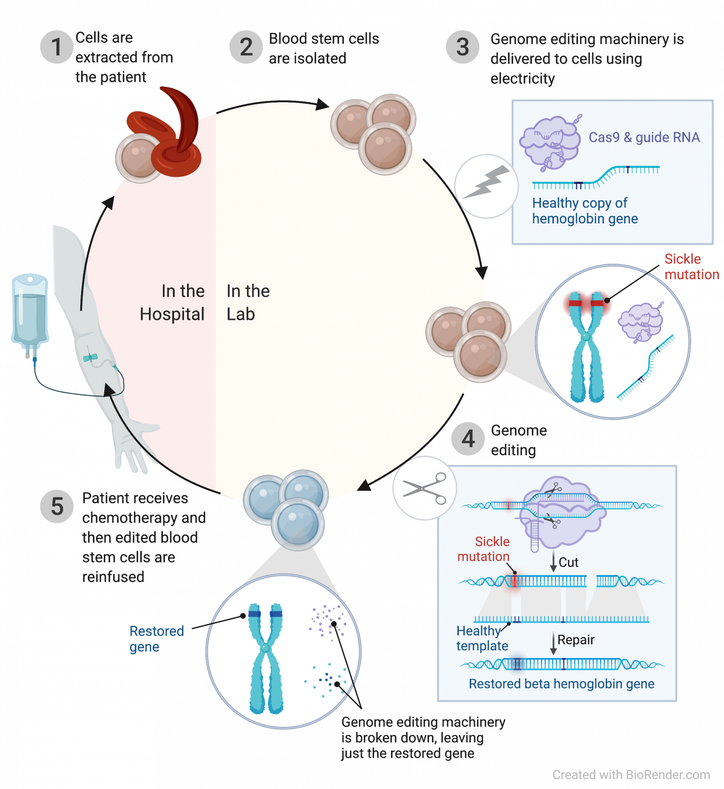 Discovery And Therapy For Sickle Cell Disease Innovative Genomics