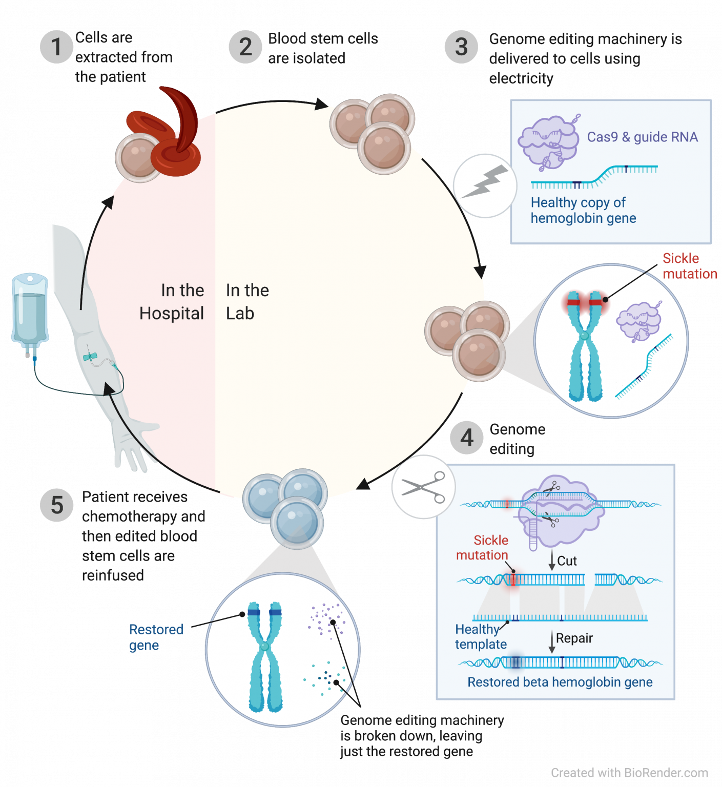 Discovery and development of a CRISPR-based therapy for sickle cell ...