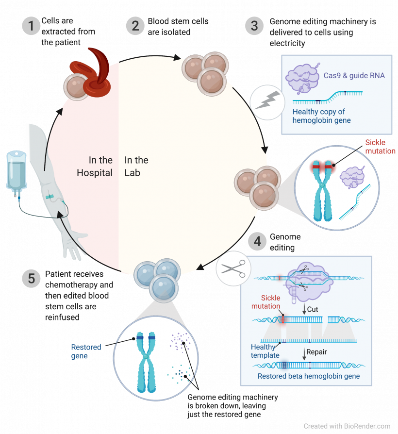 Discovery And Therapy For Sickle Cell Disease Innovative Genomics Institute Igi 0144