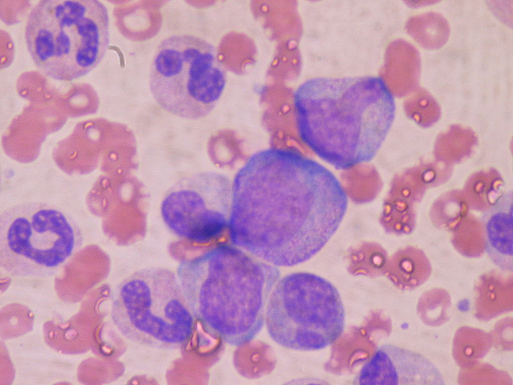 Red bone marrow cells
