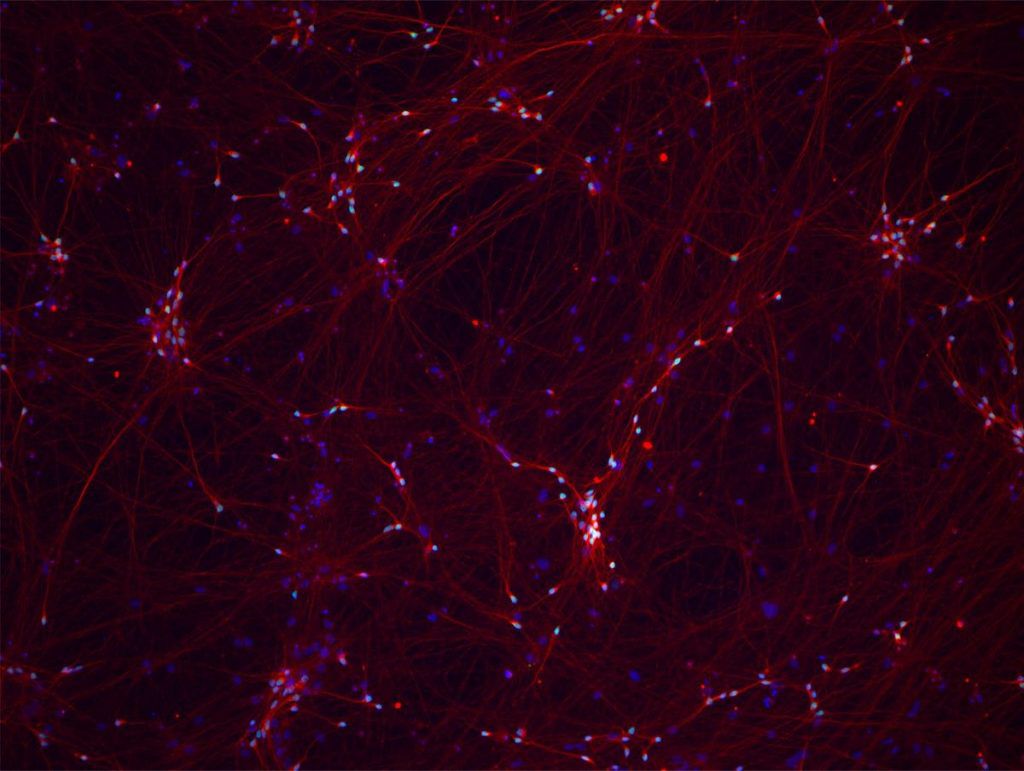Image of fluorescent human neurons