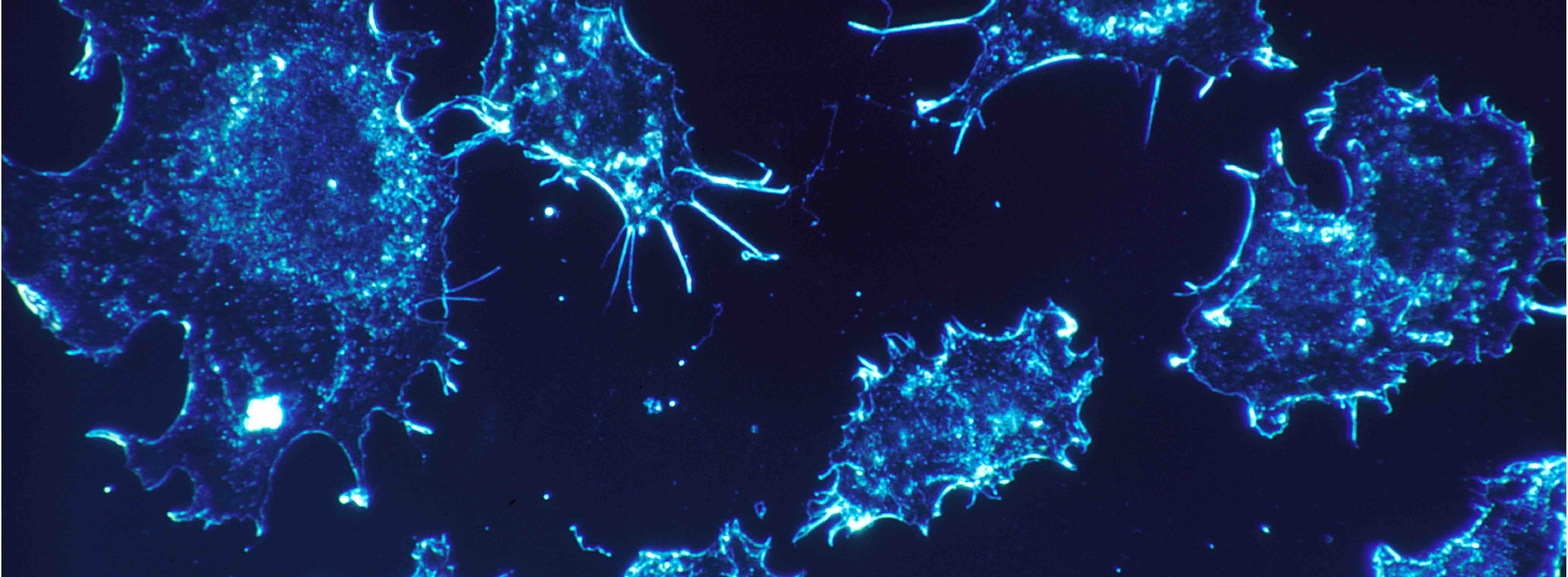 Imagen de microscopio de células cancerosas que se han coloreado de azul