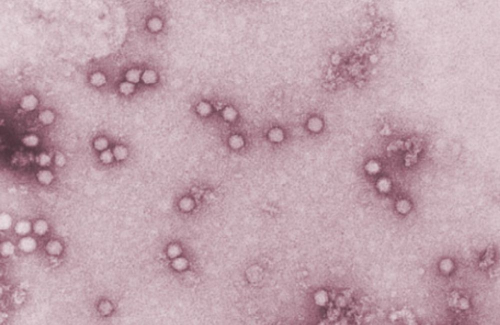 micrografía de virus adenoasociado