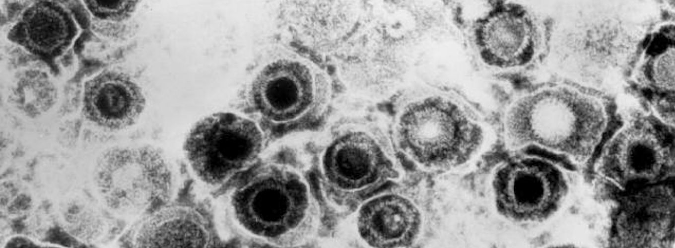 Micrografía electrónica de herpesvirus