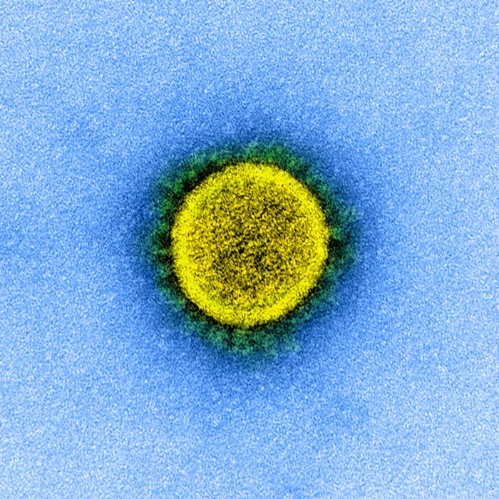 Transmission electron micrograph of SARS-CoV-2 virus particles