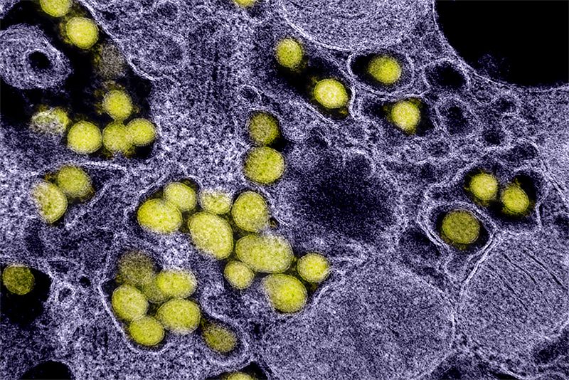 Novel Coronavirus SARS-CoV-2 electron micrograph - creating a CRISPR-based vaccine