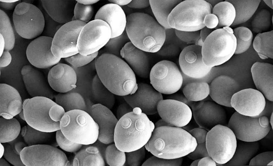 Saccharomyces cerevisiae en gemación como se ve por microscopía electrónica de barrido