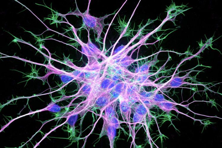 Neuron Cytoskeleton