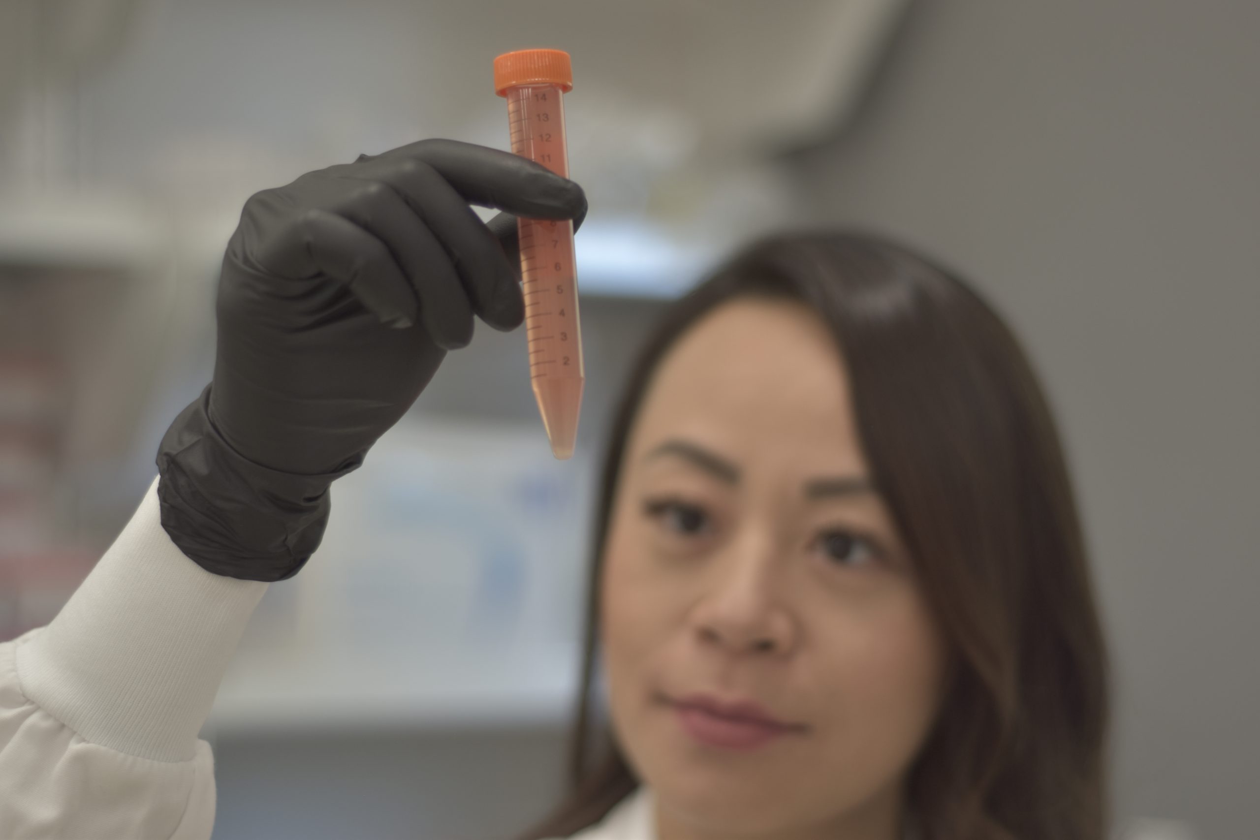 Linda Vo looks at a tube of blood stem cells