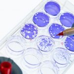 Scientist marking a clear plate with 12 circular wells. Clear zones on the purple background show the SARS-CoV-2 virus escaping from neutralizing antibodies in patient blood samples