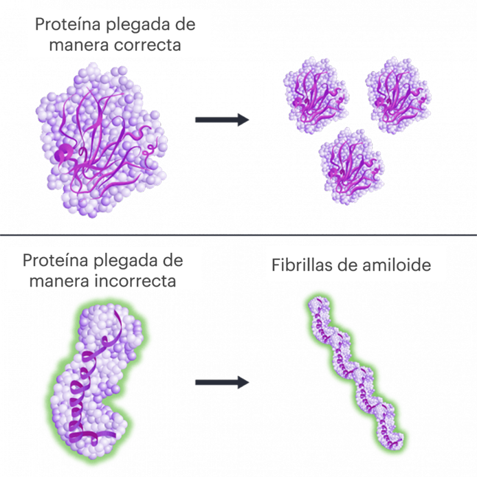 el proceso de amiloidosis