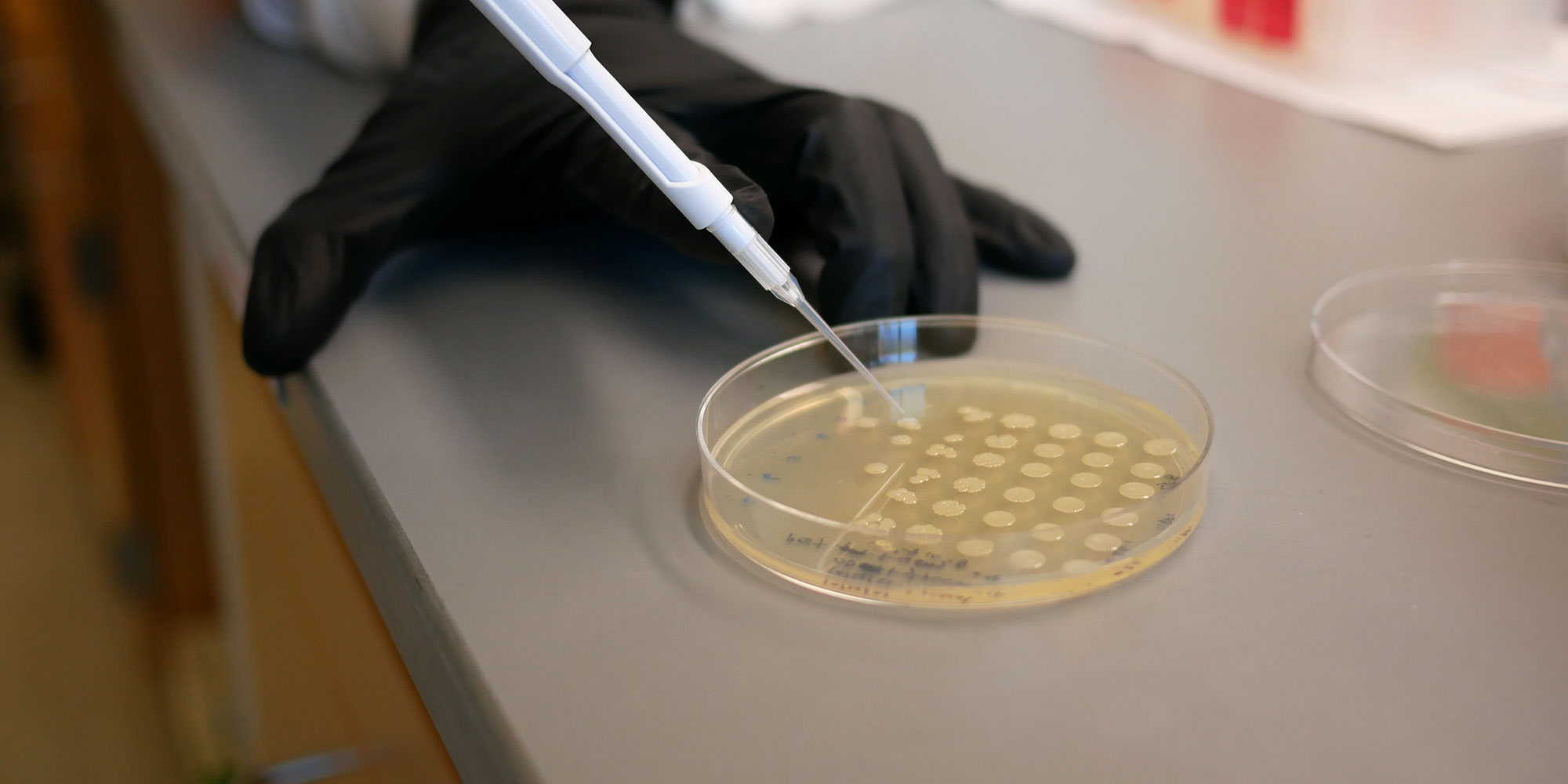 scientist pipetting a petri dish