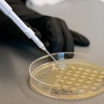 Scientist holds a pipette near a plate of bacterial colonies