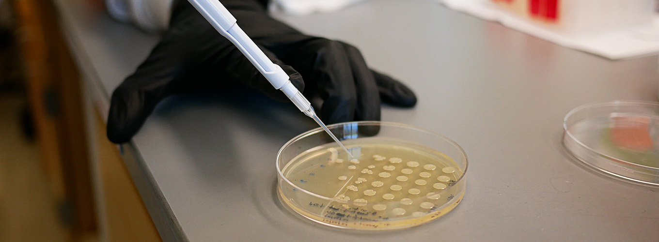 Scientist holds a pipette near a plate of bacterial colonies