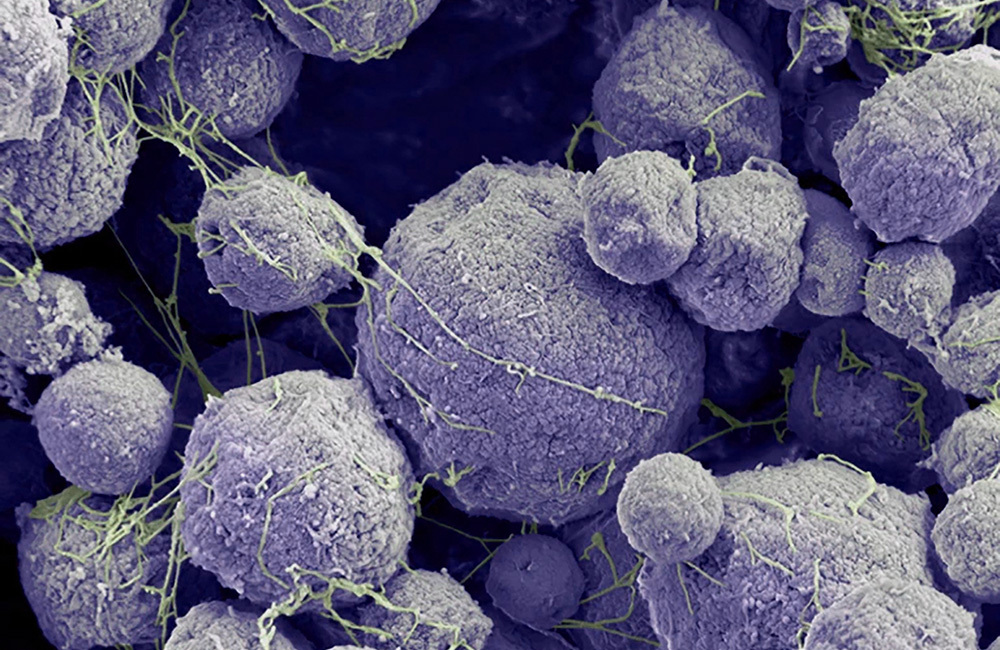 Micrograph of archaea