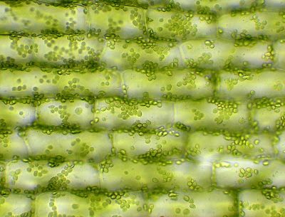 micrograph of plant cells with visible chloroplasts