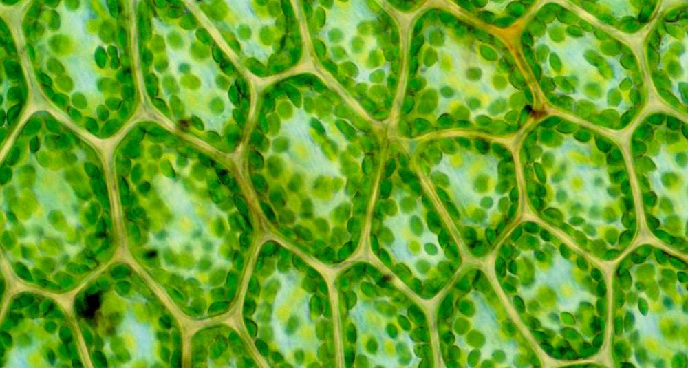 micrograph of plant cells with chloroplast visible