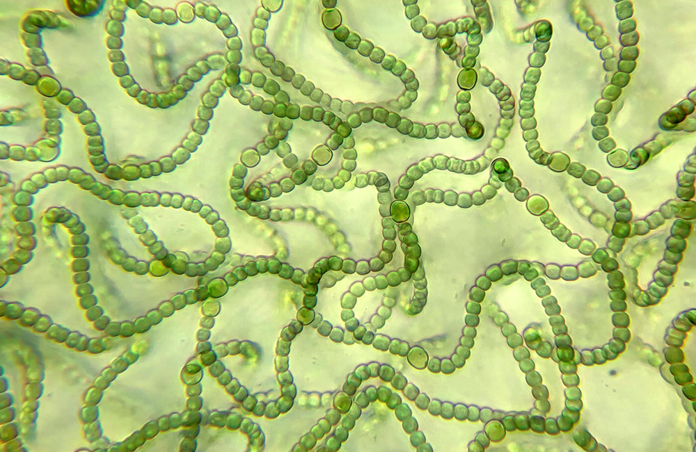 Cianobacterias Nostoc de My Microscopic World