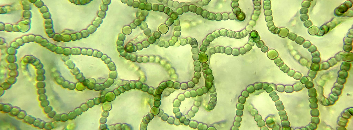 Cianobacterias Nostoc de My Microscopic World