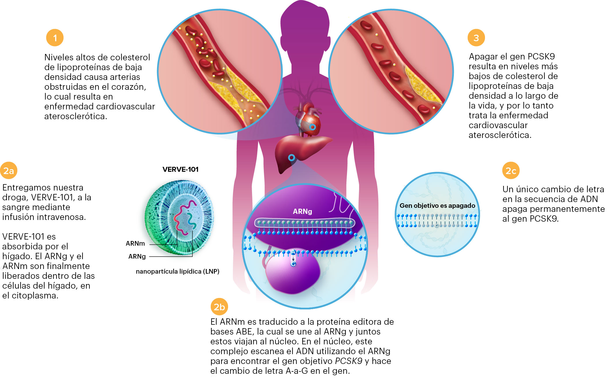 Descripción general del tratamiento de la hipercolesterolemia con componentes CRISPR administrados por nanopartículas lipídicas