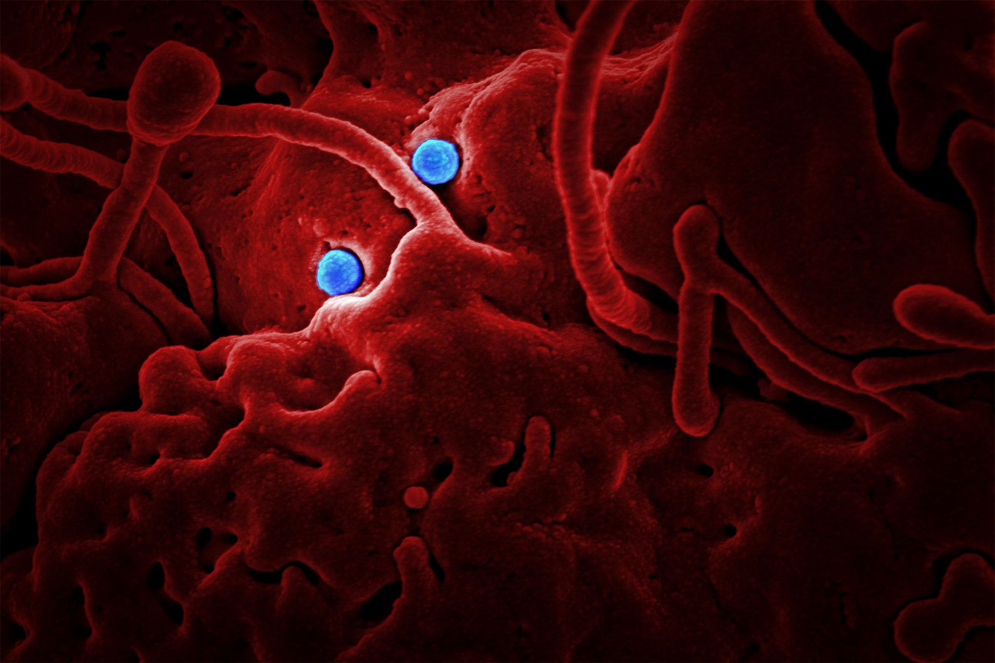 Coronavirus Ultrastructural Morphology - Developing Antisense Oligonucleotide Therapeutics for COVID-19