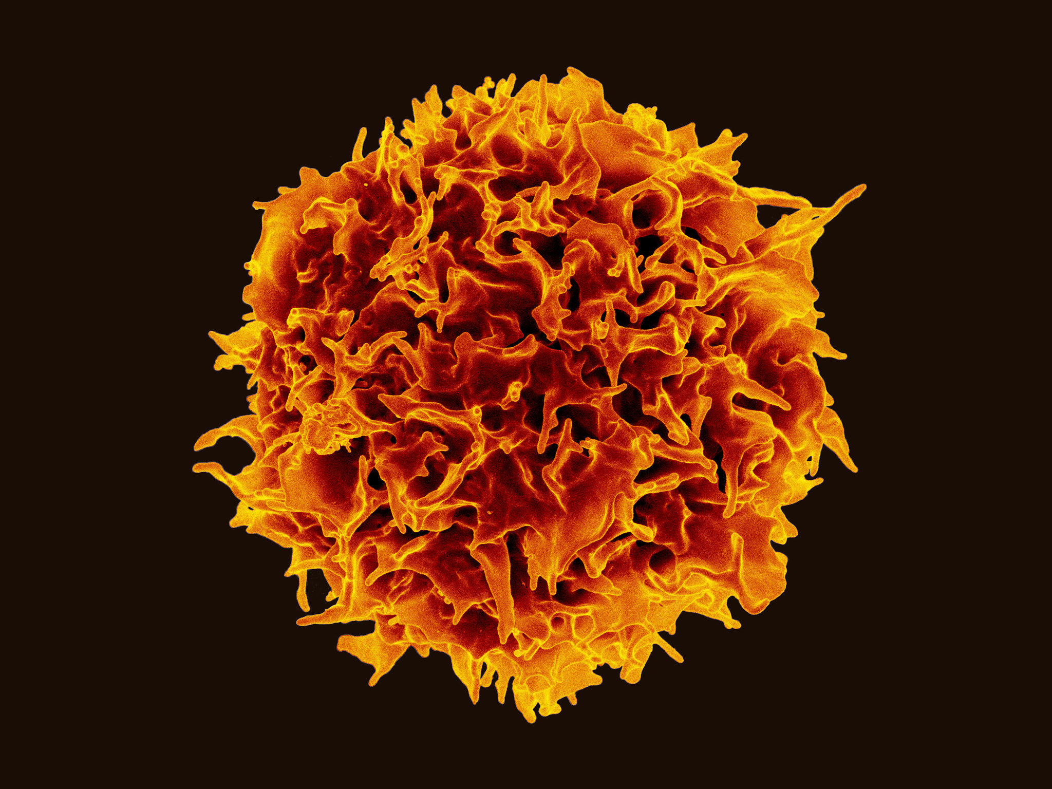 T lymphocyte