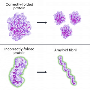 the process of amyloidosis