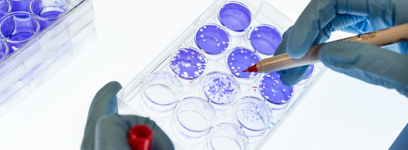 Scientist marking a clear plate with 12 circular wells. Clear zones on the purple background show the SARS-CoV-2 virus escaping from neutralizing antibodies in patient blood samples