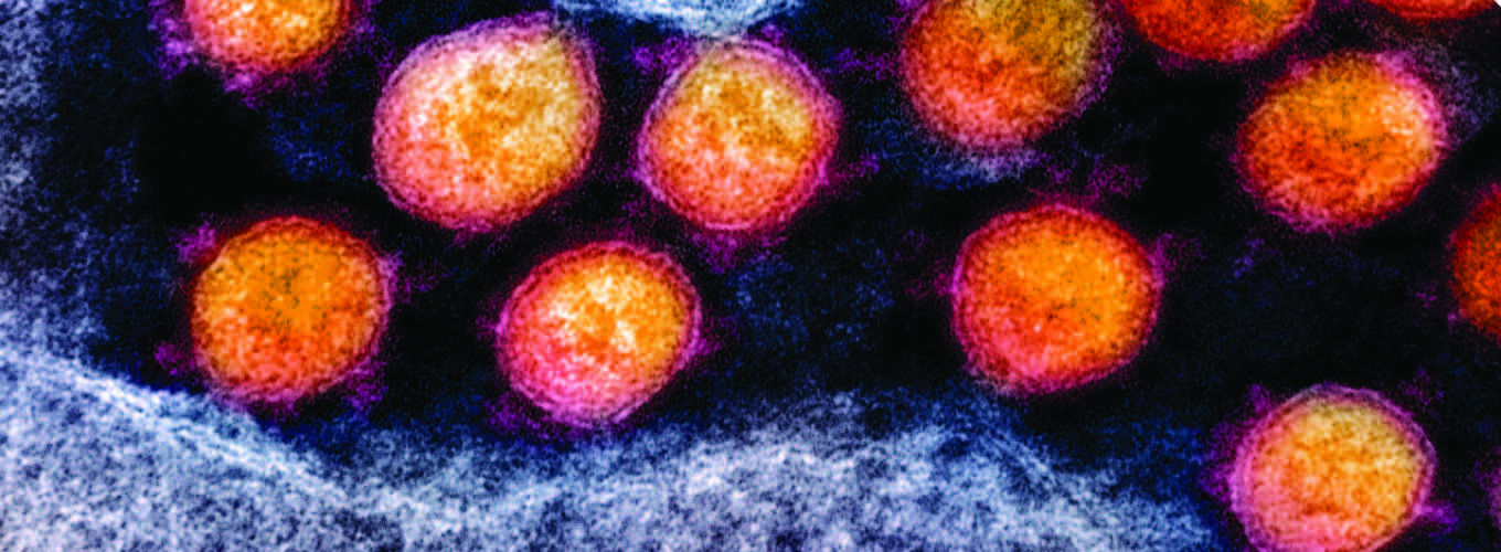 SARS-CoV-2 microgram secondary