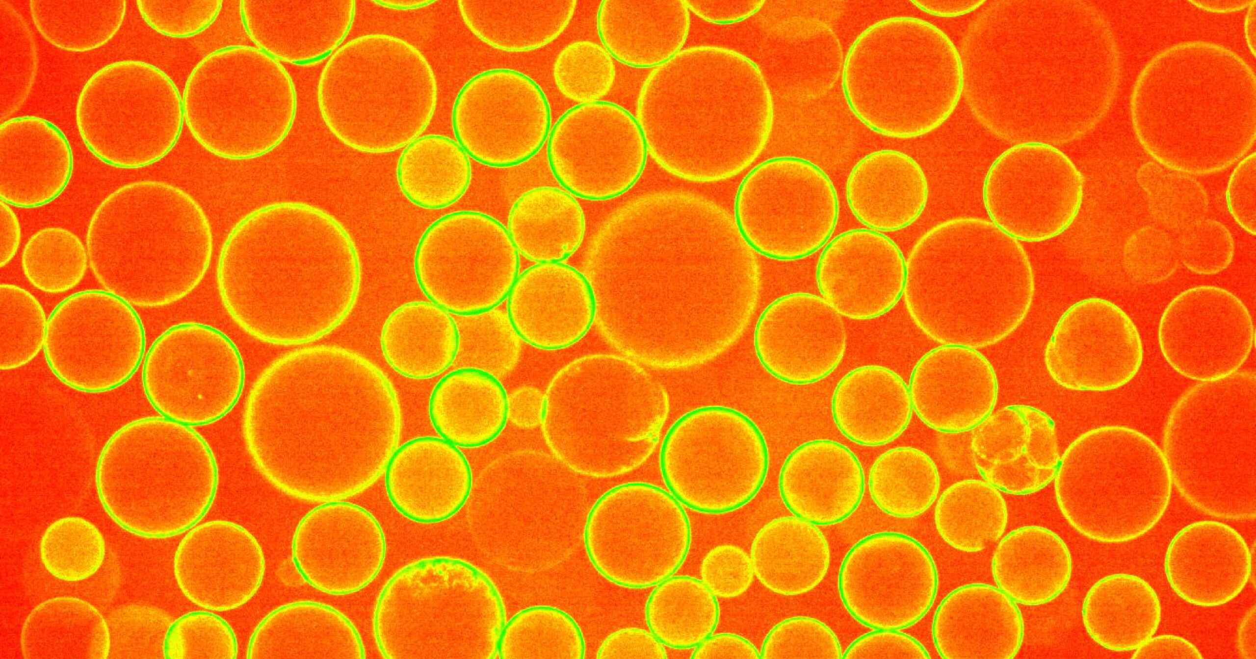 Bright orange circles from a biological experiment in the Zoncu lab