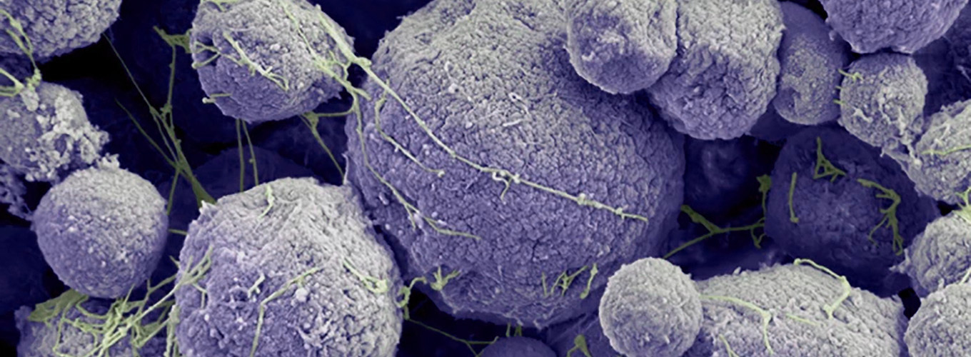 Micrograph of archaea