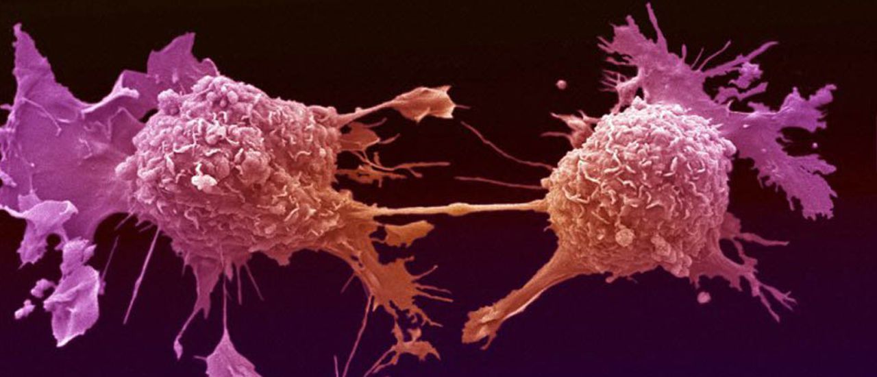 cancer cells