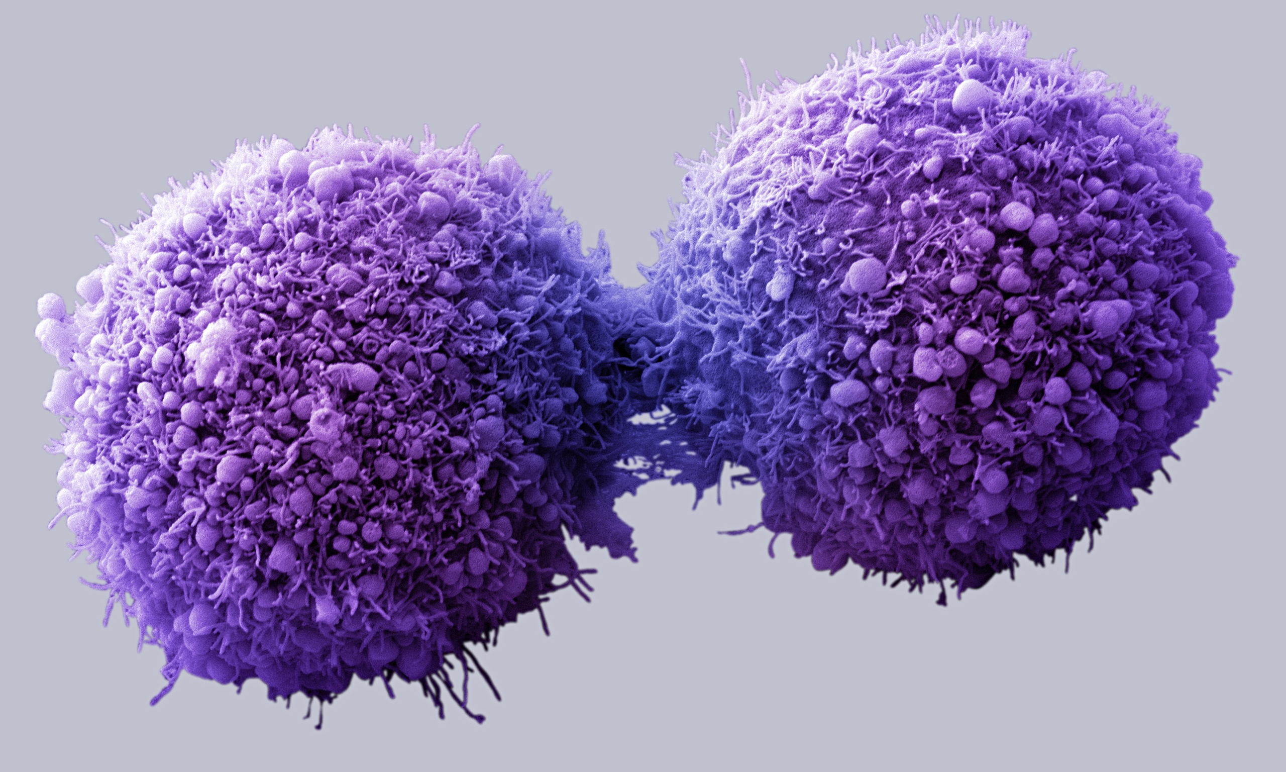 Image of pancreatic cancer cells