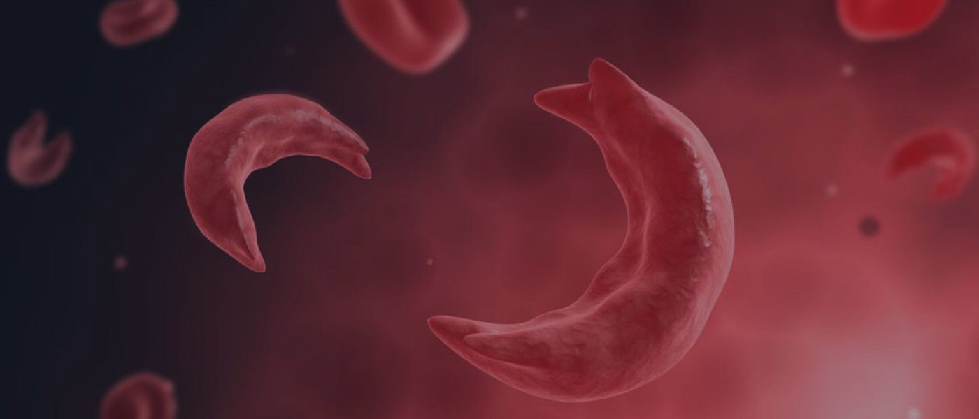 image of sickle cells