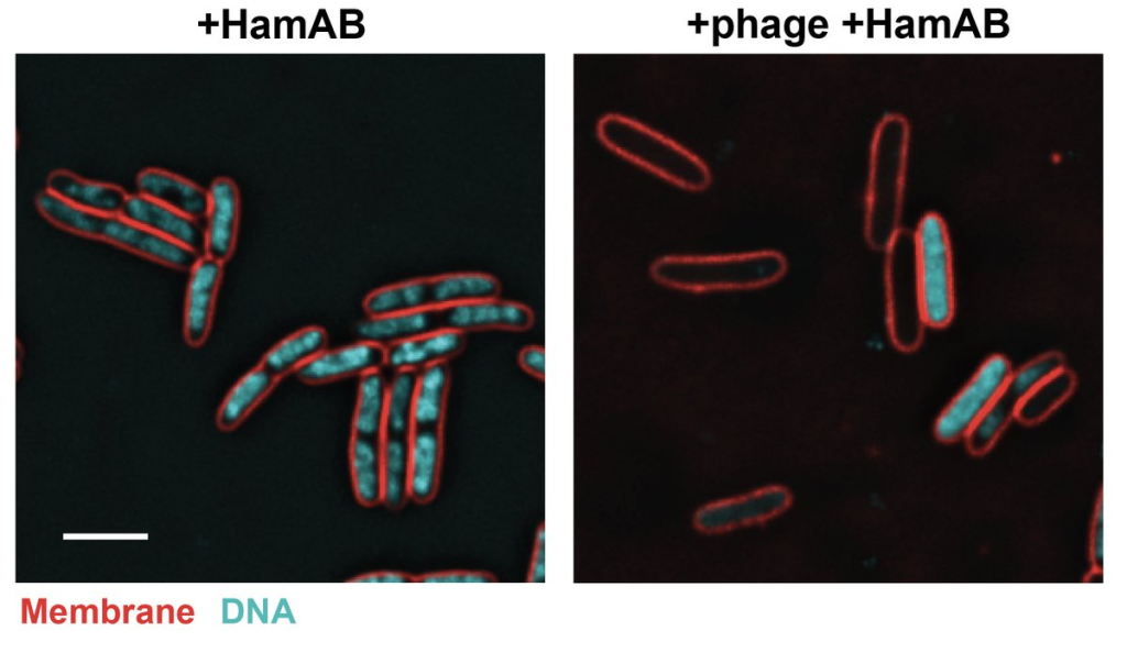 The panel on the left shows bacterial cells. The cell membrane is shown in red and the DNA is shown in teal. The panel on the right shows bacterial cells that have been exposed to bacteriophage infection: the conspicuous absence of DNA and most of these cells is a result of the Hachiman system.