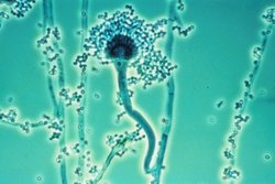 Aspergillus micrograph